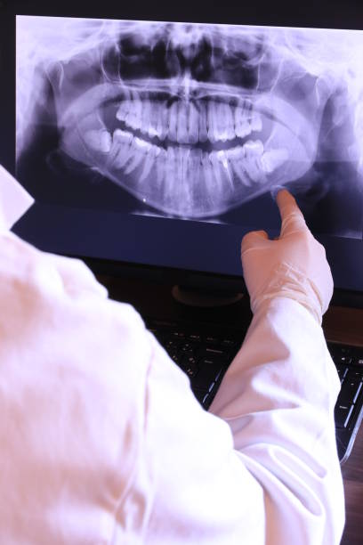 Best Knocked-Out Tooth (Avulsed Tooth) Treatment in Hickory, NC